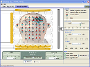 Screenshot of the simulation 簡化的磁共振造影MRI